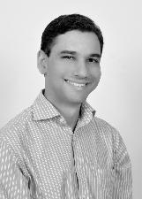 Foto de ALBERES HANIERY PATRICIO LOPES