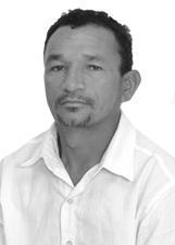 Foto de HIGO DA SILVA DANTAS