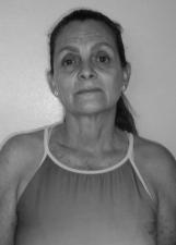 Foto de NILDA BOTELHO DE ARAUJO MELO