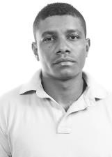 Foto de ALBERTO PORTO CIRCUNCISÃO