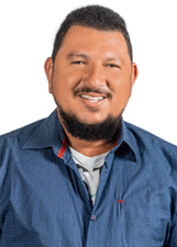 Foto de LEVI SANTOS SPINOLA