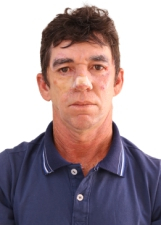 Foto de ANTONIO DE CALDAS LIMA
