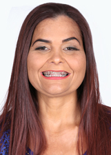 Foto de SIRLENE XAVIER DOS REIS
