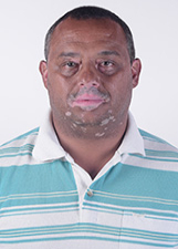 Foto de ALISSON APARECIDO BORGES