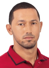 Foto de JHONY FERNANDES MOTÉ