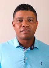 Foto de ALBERTO PORTO CIRCUNCISÃO