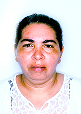 Foto de MARCEA LOPES DA SILVA COSTA